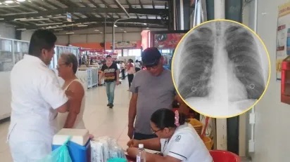 Veracruz ocupa el octavo lugar nacional por casos de neumonía: IMSS exhorta a vacunarse